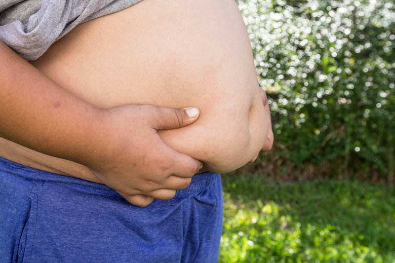 Obezita u detí