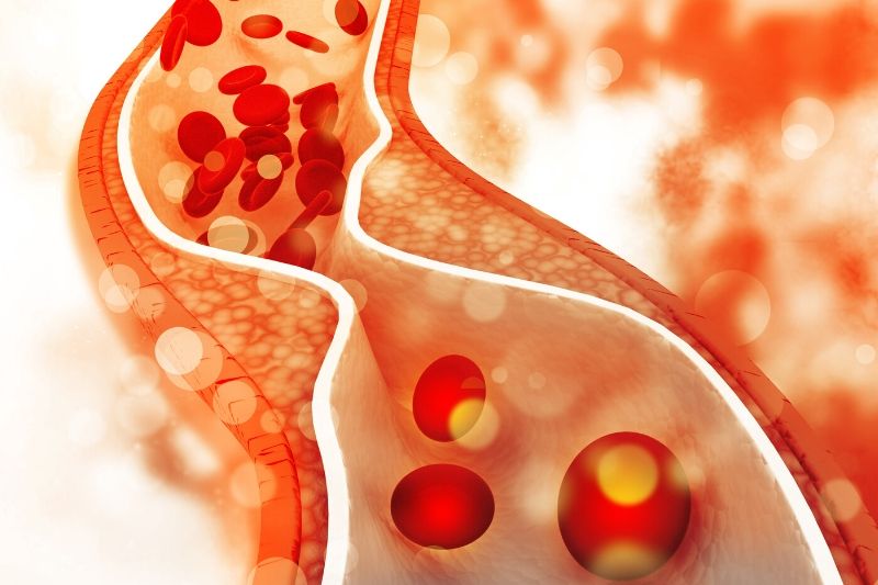 cholesterol