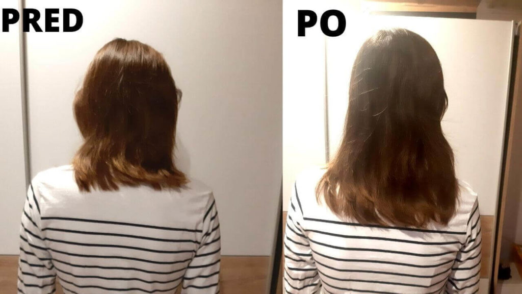 moje vlasy pred a po skončení Curapil kúry